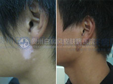 ���Զ��������Ͱ���2��