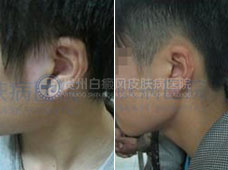 �������沿����4����