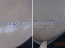 26��Ů�Ը���������3��