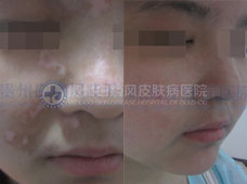 ��ͯ�沿�������װ�һ���