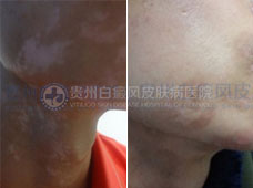 ��24���澱���װ�20����