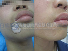 ����ǰװ�һ���