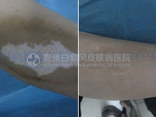 ��ͯ�Ȳ�������4�꣬����Ժ������Ժ