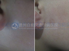 ��ͯ�沿�����Ͱ���2����