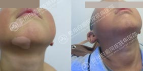 ��ͯ������ô���ƿ�ѧ��ȫ