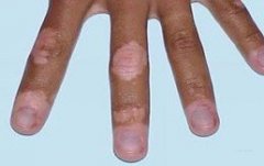 �ֲ�Ϊʲô�׻�����