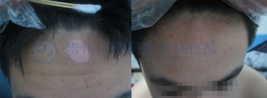 ������ͷ�������԰���2����