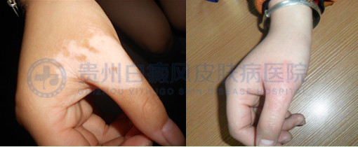 Ů���ֲ������Ͱ���4������Ժ4�����κ�