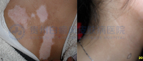 �������ز�������2�꣬����Ժ4�����κ�