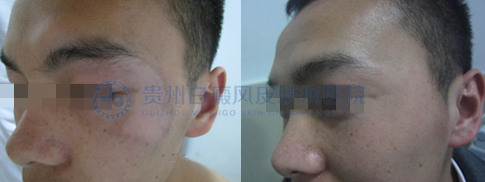 �����������װ�������