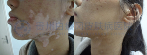 20��Ů���沿�������������