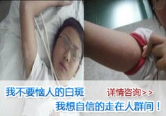 ���������аװߣ��ҳ�������ע��