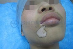 �����沿����������Щ֢״