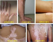 �ز��װ��ǲ��ǰ���