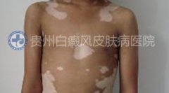 �ز�����Ҫ������