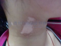 ר�ҽ���������������֢״������