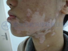 ��ô���ж��沿�����֢״��?