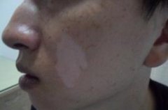 ������ʳ��ע����Щ��