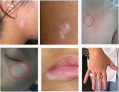 �������֢״