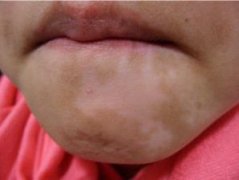 ���ϳ��װ��ǰ�����ô�죿