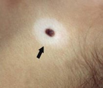 �����Ͱװ���Ҫ������