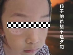 ��ͯ��������Ϊʲô��ô���׻����磿