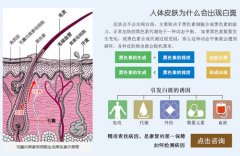 ���粻�Ǿ�֢��Ϊʲô�����β��ã�