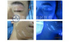 û���˰װ� ���������