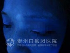 �κð��� ��ӵ��������