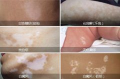 Ƥ���ϳ��װ�����ô���£�