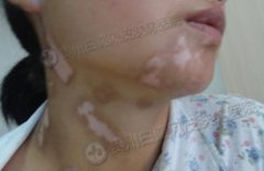 308׼���ӹ����ư���Ч�����𣿹󲻹�