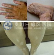 ֫���Ͱ����һ��������������������������