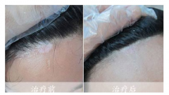 ���ư��� ץס���ڡ�רҵ�ڡ�