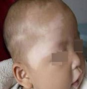 ��ͯ��������Щ�ص�