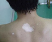 ���԰����֢״����Щ��