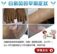 �������ͼƬʲô�����������͵İ���ͼƬ