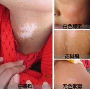 С�����ϳ��ְ�����ô�죿