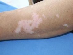 �첲�����׻�������ʲôԵ��