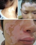 �����껼����ļ���Ϊʲô��