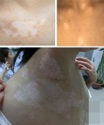 �ز���������Щ֢״��