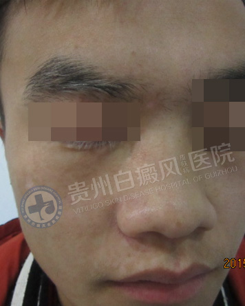 ���԰��簸��