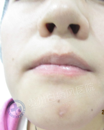 ��������簸��