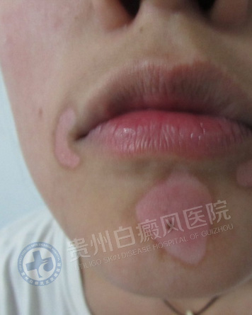 ��������簸��