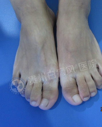 ������簸��