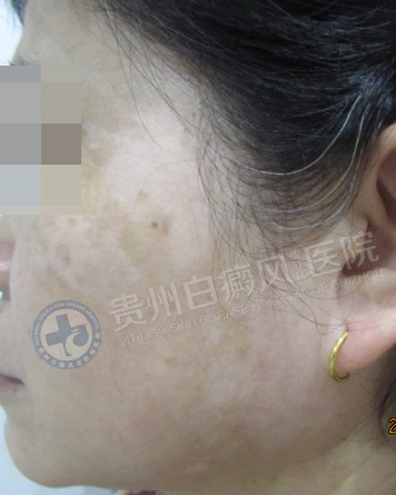 ���˰��簸��