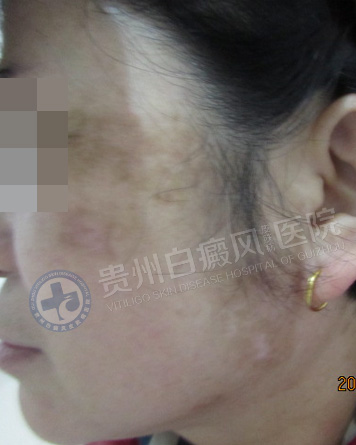 ���˰��簸��