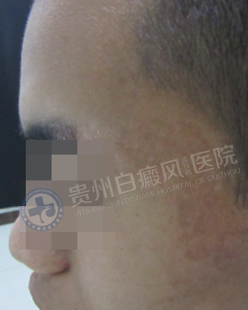 ��������簸��