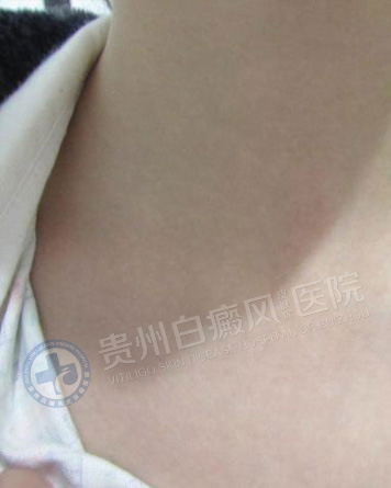 ���˰��簸��