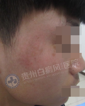 ���˰��簸��