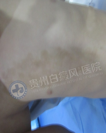 ��ͯ���簸��